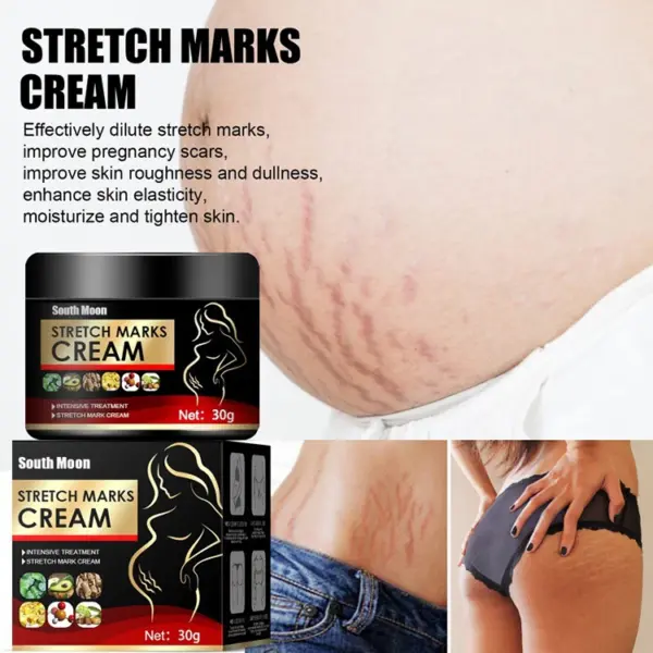 Stretch Marks Repair Body Lotion - Image 2