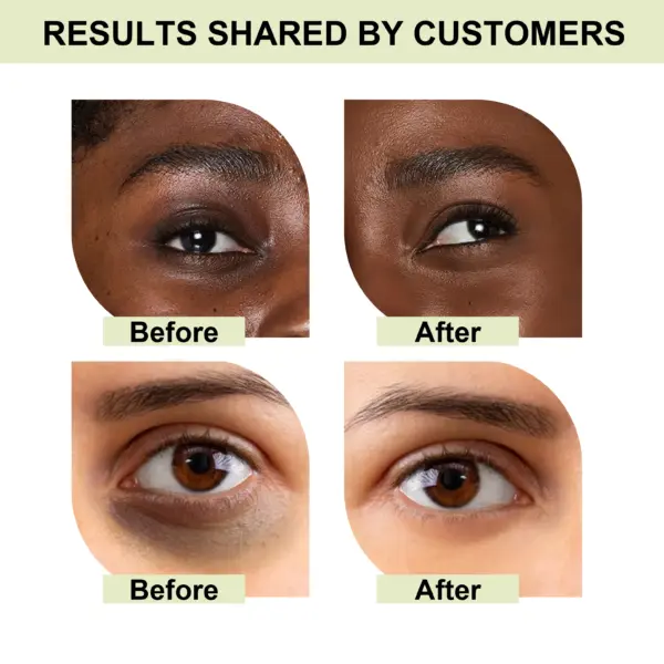 Retinol Anti-Wrinkle Brightening Eye Cream - Image 3