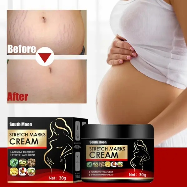 Stretch Marks Repair Body Lotion - Image 5