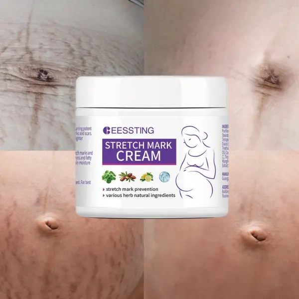 Premium Stretch Mark Repair Cream - Image 2