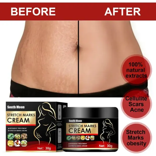 Stretch Marks Repair Body Lotion - Image 4